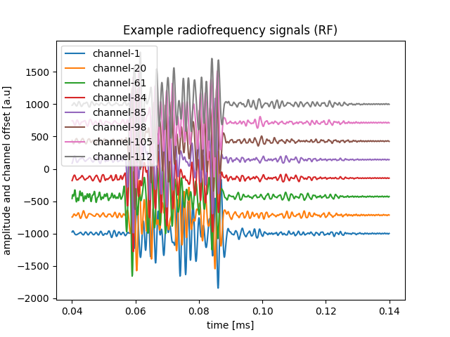 Example radiofrequency signals (RF)